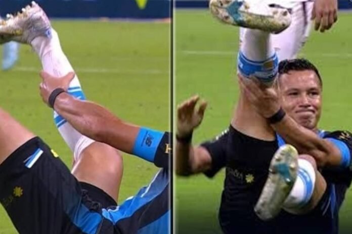 Brutal lesión en Brasil: Marlon se queda con el tobillo colgando tras sufrir una grave fractura